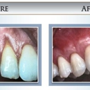 Spector, Sidney L DDS PC - Implant Dentistry
