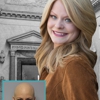Elite Hair Loss Solutions gallery