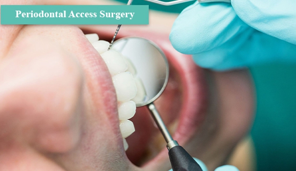 Perio Health Specialists - Dandenong, VIC. Periodontal Access Surgery