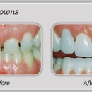 All Smiles Dental - Implant Dentistry