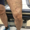 Chicago Vein Care Center gallery