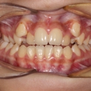 Ortega Dental Care - Implant Dentistry