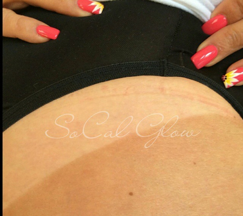 SoCal Glow Mobile Spray Tanning - North Dartmouth, MA
