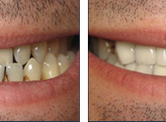 Sabal Dental - Alameda - Corpus Christi, TX