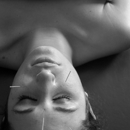 Breathe - The Wellness Society - Acupuncture