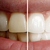JK Family Dental Inc gallery