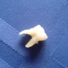 Lafevers Dental Team DDS PA gallery
