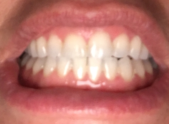 Gottlieb & Daniels Orthodontics - Cheshire, CT. After