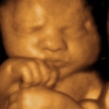 A Little Insight 3d 4d Ultrasound gallery