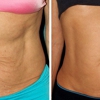 Newport Fat Loss and More (Body Sculpting) gallery