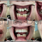 Naples Dental & Denture Center Inc