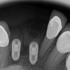 Dr Smilee Dental of Killeen, Family, Cosmetic, Implant, Medspa gallery