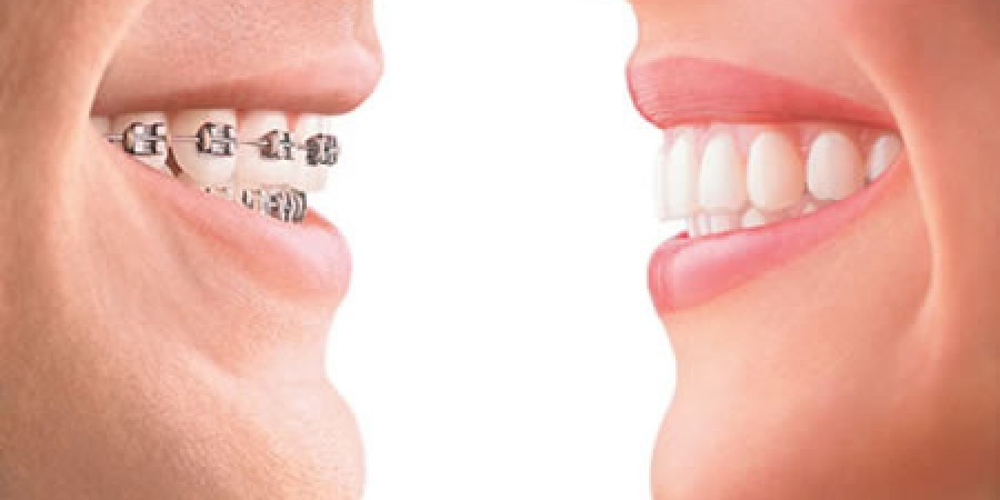Dental Max