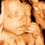 Clear Image 4D Ultrasound : Staten Island