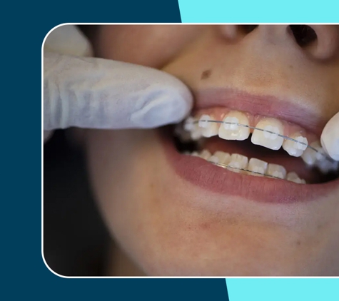 Orthodontix Forestville - Forestville, NSW. Leading Braces Specialist