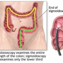 Colon & Rectal Surgery Associates - Physicians & Surgeons