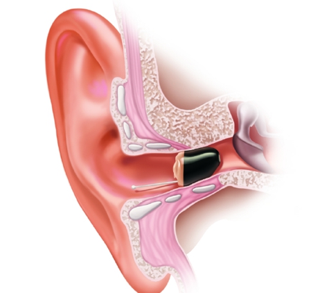 Holly's Hearing Aid Center - Ashtabula, OH