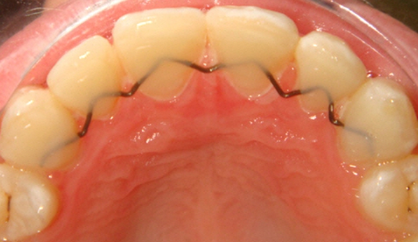 Hunter Valley Orthodontics - Hamilton South, NSW