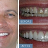 Almeida & Bell Dental Lone Tree - General, Cosmetic, and Implant Dentistry gallery