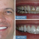 Almeida & Bell Dental Lone Tree - General, Cosmetic, and Implant Dentistry - Cosmetic Dentistry