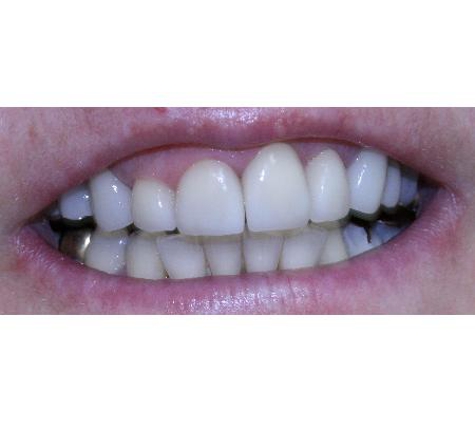 A Better Dental Care - Berwick, VIC