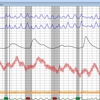 JNE Polygraph gallery