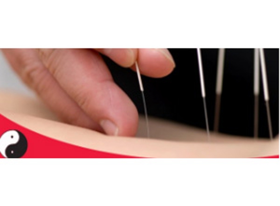 Centre of Chinese Acupuncture - North Perth, WA