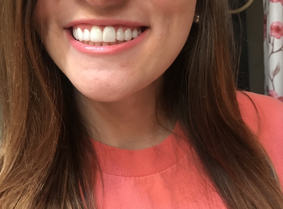 Sisk, Stanley DDS - Knoxville, TN. Absolutely in love with my veneers! DR Sisk did an amazing job!