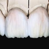 cosmetic dental lab gallery