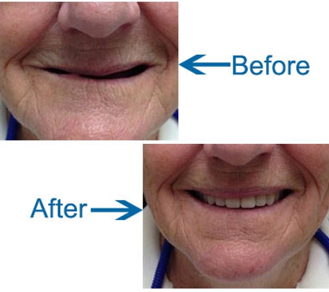 Cronulla Denture Care