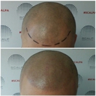 Scalp Aesthetics Los Angeles