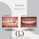 Gulch Dental Studio - Cosmetic Dentistry