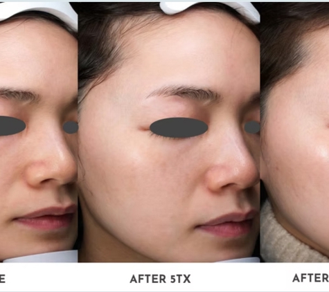 Clean Laser Clinics - Teneriffe, QLD