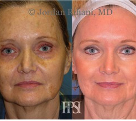 Facial Plastic Surgery Institute - Fort Worth, TX