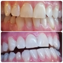 Smile Labs PDX - Teeth Whitening Products & Services