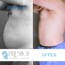 Prestige Cosmetic Surgery - Skin Care