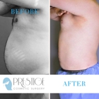 Prestige Cosmetic Surgery