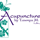 Acupuncture By Tawnya Salas