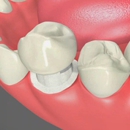Blue Stone Dental - Implant Dentistry