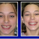 North Kansas City Dental - Implant Dentistry