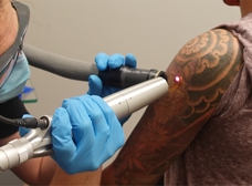 Laser Tattoo Removal TakeItOffLaser  Twitter