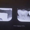 Island Dental gallery
