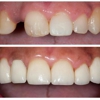 Providence Dental Spa | East Cobb gallery