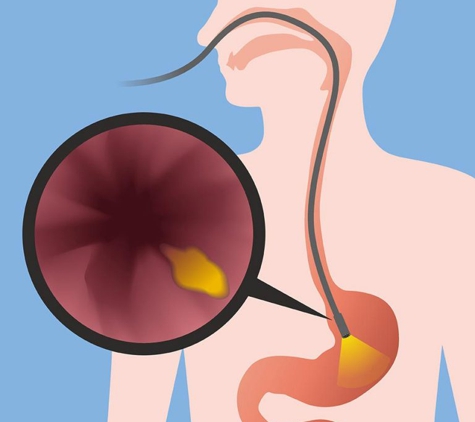 Prof Luke Hourigan Interventional Gastroenterologist - Greenslopes, QLD