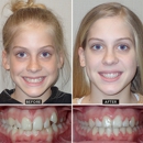Horner Barrow Orthodontics, PC - Orthodontists