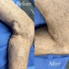 Gerard F. Vitale, MD - Vitale Vein & Vascular Center gallery