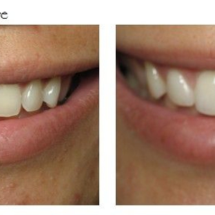 StarBrite Dental-Dr. Munira Lokhandwala DDS, FAGD, FICOI - Fremont, CA