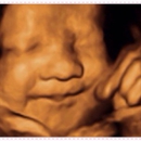4D Moments Ultrasound LLC - Pregnancy Information & Services