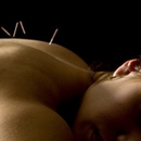 Dr. Yu Center of Life Style Excellence - Acupuncture