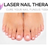 Laser Nail Therapy- Largest Toenail Fungus Treatment Center gallery